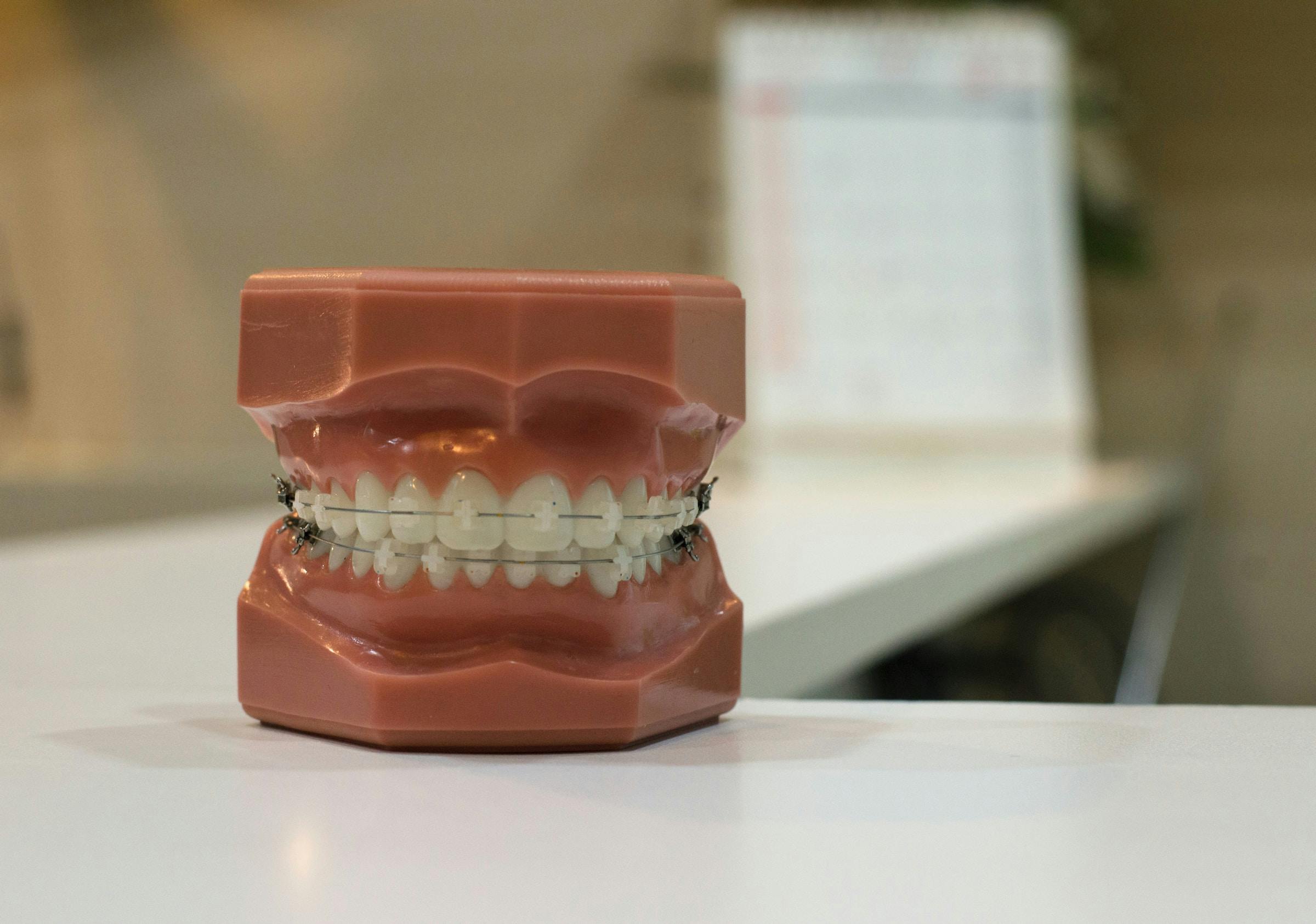 Зубні пасти: на які інгредієнти слід звернути увагу у складі
