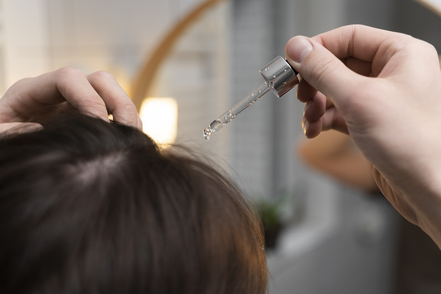 Finasteride vs Minoxidil: порівнюємо засоби проти випадіння волосся